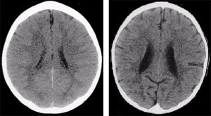 Brousblog1a Perry brains X-sec